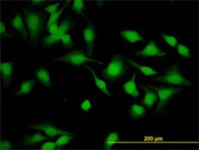Immunocytochemistry/Immunofluorescence: Cytohesin 2 Antibody (6H5) [H00009266-M02] - Analysis of monoclonal antibody to CYTH2 on HeLa cell. Antibody concentration 10 ug/ml.
