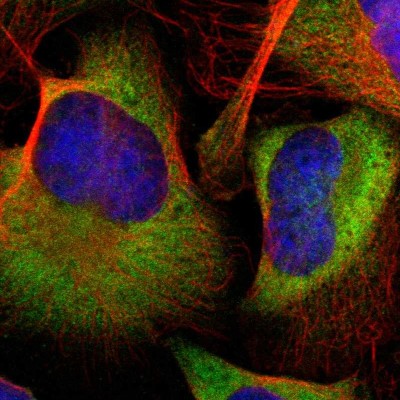 Immunocytochemistry/Immunofluorescence: FKBP25 Antibody [NBP1-87929] - Immunofluorescent staining of human cell line U-2 OS shows localization to cytosol.