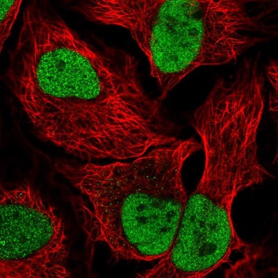 Immunocytochemistry/Immunofluorescence: PDE7B Antibody [NBP1-85987] - Immunofluorescent staining of human cell line HeLa shows localization to nucleoplasm.