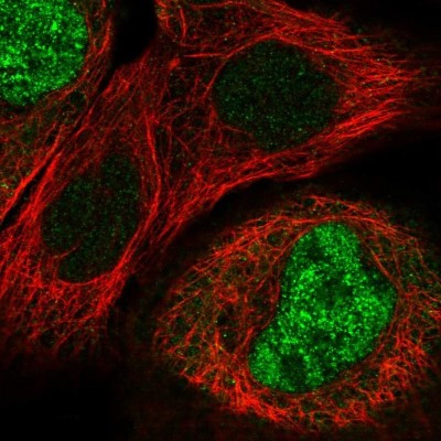 Immunocytochemistry/Immunofluorescence: PDE7B Antibody [NBP1-85987] - Staining  of human cell line A-431 shows positivity in nuclei but not nucleoli.