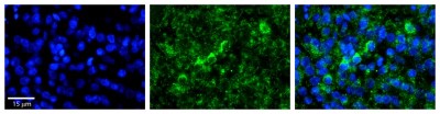 Immunocytochemistry/Immunofluorescence: WBP11 Antibody [NBP1-54648] - Formalin Fixed Paraffin; Embedded Tissue: Human Pineal Tissue; Observed Staining: Cytoplasmic in cell bodies of pinealocytes and their processes; Primary Antibody Concentration: 1:100