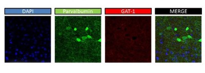 Immunocytochemistry/Immunofluorescence: GAT1 Antibody [NBP1-59878] - mouse brain slices, 1:1000