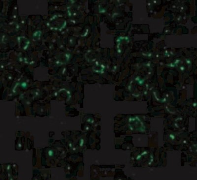 Immunocytochemistry/Immunofluorescence: CARD10 Antibody [NBP1-76676] - Immunofluorescence of CARD10 in EL4 cells with CARD10 antibody at 20 ug/mL.
