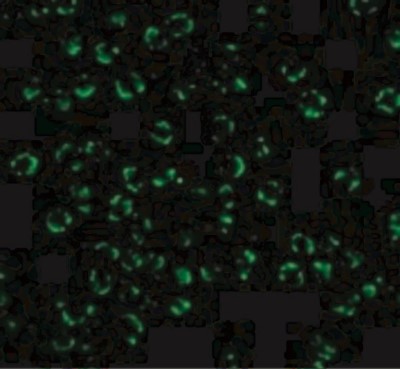 Immunofluorescence: RIPK2 Antibody [NBP1-76873] - Immunofluorescence of RICK in K562 cells with RICK antibody at 20 ug/mL.