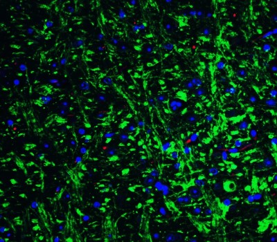 Immunocytochemistry/Immunofluorescence: GluR5/GRIK1 Antibody [NBP1-76849] - Staining of Grik1 in mouse brain tissue with Grik1 Antibodyat 20 ug/mL.