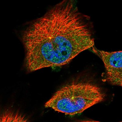 Immunocytochemistry/Immunofluorescence: SLC12A3 Antibody [NBP1-86376] - Staining  of human cell line U-251MG shows positivity in nucleus but not nucleoli, cytoplasm and centrosome.