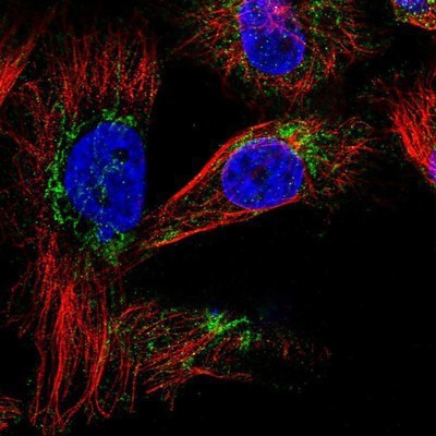 Immunocytochemistry/Immunofluorescence: SLC25A20 Antibody [NBP1-86689] - Staining of human cell line U-251 MG shows positivity in cytoplasm and mitochondria.