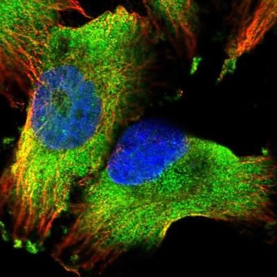 Immunocytochemistry/Immunofluorescence: PUM1 Antibody [NBP1-87856] - Staining of human cell line U-251 MG shows positivity in cytoplasm.
