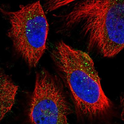 Immunocytochemistry/Immunofluorescence: NEU-1/Sialidase-1 Antibody [NBP1-87755] - Immunofluorescent staining of human cell line U-251 MG shows localization to vesicles.