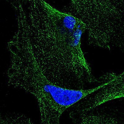 Immunocytochemistry/Immunofluorescence: CABP5 Antibody [NBP1-86691] - Staining of human cell line U-2 OS shows positivity in cytoplasm and cytoskeleton (microtubules).