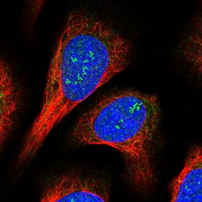 Immunocytochemistry/Immunofluorescence: CCDC4 Antibody [NBP1-88163] - Staining of human cell line U-2 OS shows positivity in nucleus, nucleoli and cytoplasm.