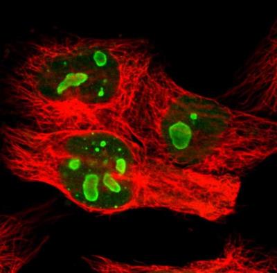 Immunocytochemistry/Immunofluorescence: Pea3 Antibody [NBP1-87960] - Staining of human cell line U-251 MG shows localization to nucleoli. Antibody staining is shown in green.