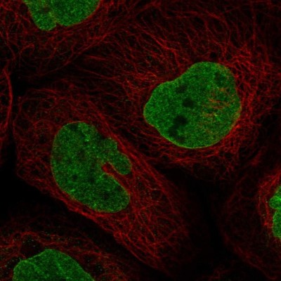 Immunocytochemistry/Immunofluorescence: DNA polymerase sigma Antibody [NBP2-13728] - Immunofluorescent staining of human cell line A-431 shows localization to nucleoplasm & nuclear membrane.