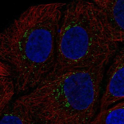 Immunocytochemistry/Immunofluorescence: NOXA1 Antibody [NBP1-92197] - Staining of human cell line HaCaT shows localization to vesicles.