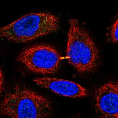 Immunocytochemistry/Immunofluorescence: SLFN13 Antibody [NBP1-93879] - Staining of human cell line A549 shows localization to cytokinetic bridge.