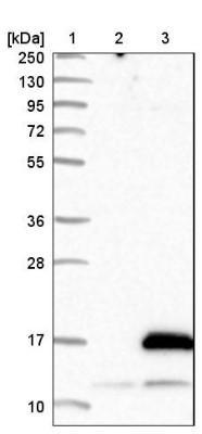 Western Blot: ATPase Inhibitory Factor 1 Antibody [NBP1-90069] - Lane 1: Marker [kDa] 250, 130, 95, 72, 55, 36, 28, 17, 10. Lane 2: Negative control (vector only transfected HEK293T lysate). Lane 3: Over-expression lysate (Co-expressed with a C-terminal myc-DDK tag (3.1 kDa) in mammalian HEK293T cells).