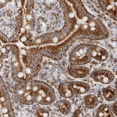 Immunohistochemistry-Paraffin: ATPase Inhibitory Factor 1 Antibody [NBP1-90069] - Staining of human duodenum shows strong granular cytoplasmic positivity in glandular cells.
