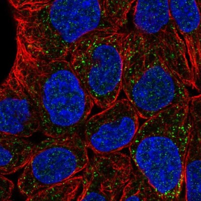 Immunocytochemistry/Immunofluorescence: FAR1 Antibody [NBP1-89847] - Staining of human cell line RT4 shows localization to peroxisomes.