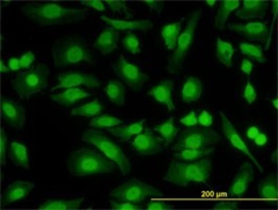 Immunocytochemistry/Immunofluorescence: PKNOX2 Antibody (4B6) [H00063876-M01] - Analysis of monoclonal antibody to PKNOX2 on HeLa cell. Antibody concentration 10 ug/ml.
