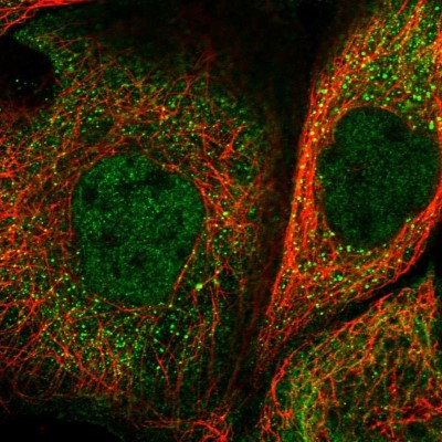 Immunocytochemistry/Immunofluorescence: ACSL6 Antibody [NBP1-89269] - Staining of human cell line A-431 shows positivity in nucleus but not nucleoli and cytoplasm.