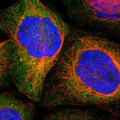 Immunocytochemistry/Immunofluorescence: RNF213 Antibody [NBP1-88466] - Immunofluorescent staining of human cell line A-431 shows localization to cytosol.