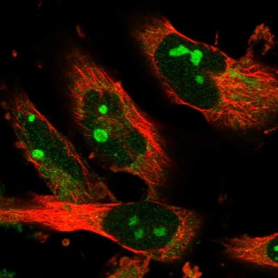 Immunocytochemistry/Immunofluorescence: Sec8 Antibody [NBP1-89597] - Immunofluorescent staining of human cell line U-251 MG shows localization to nucleoli.