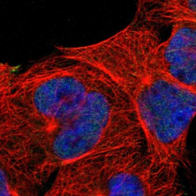 Immunocytochemistry/Immunofluorescence: VPREB3 Antibody [NBP1-89347] - Staining of human cell line A-431 shows positivity in nucleus but not nucleoli.