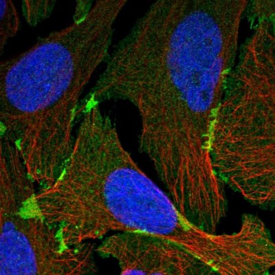 Immunocytochemistry/Immunofluorescence: EPB41L3 Antibody [NBP1-89372] - Immunofluorescent staining of human cell line U-2 OS shows localization to plasma membrane.