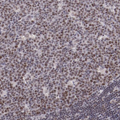 Immunohistochemistry-Paraffin: E74 like factor 1 Antibody [NBP1-90352] - Staining of human lymph node shows distinct nuclear positivity in germinal center cells.
