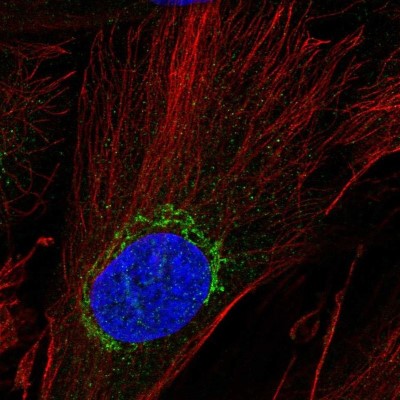 Immunocytochemistry/Immunofluorescence: ADAMTSL5 Antibody [NBP1-93438] - Staining of human cell line BJ shows localization to the Golgi apparatus.