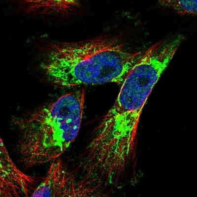 Immunocytochemistry/Immunofluorescence: DENND2A Antibody [NBP1-90465] - Staining of human cell line U-251 MG shows positivity in mitochondria.
