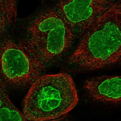 Immunocytochemistry/Immunofluorescence: CCDC34 Antibody [NBP1-93558] - Immunofluorescent staining of human cell line A-431 shows localization to nucleoli fibrillar center & nuclear membrane.