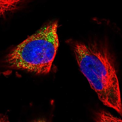Immunocytochemistry/Immunofluorescence: PLC-gamma 2 Antibody [NBP1-87558] - Immunofluorescent staining of human cell line U-251 MG shows localization to vesicles.