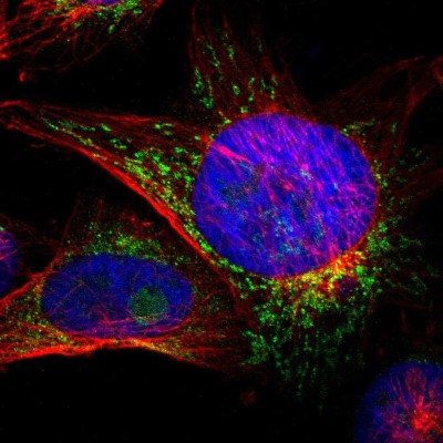 Immunocytochemistry/Immunofluorescence: ACSL5 Antibody [NBP2-31995] - Immunofluorescent staining of human cell line U-251 MG shows localization to nucleoli & mitochondria.
