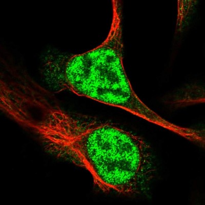 Immunocytochemistry/Immunofluorescence: RAD54L Antibody [NBP2-33916] - Immunofluorescent staining of human cell line U-2 OS shows localization to nucleoplasm.