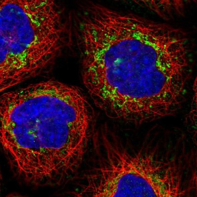 Immunocytochemistry/Immunofluorescence: MCCC2 Antibody [NBP2-38403] - Immunofluorescent staining of human cell line A-431 shows localization to mitochondria.
