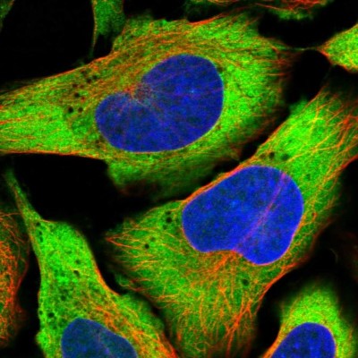 Immunocytochemistry/Immunofluorescence: PDSS2 Antibody [NBP1-88739] - Immunofluorescent staining of human cell line U-2 OS shows localization to cytosol.
