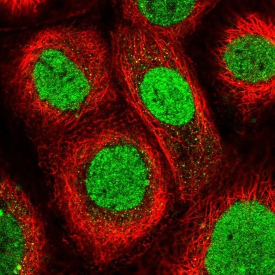 Immunocytochemistry/Immunofluorescence: CGI-09 Antibody [NBP2-13486] - Immunofluorescent staining of human cell line A-431 shows localization to nucleus.