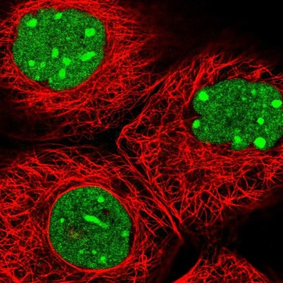 Immunocytochemistry/Immunofluorescence: FAM32A Antibody [NBP2-30704] - Immunofluorescent staining of human cell line A-431 shows localization to nucleus & nucleoli.