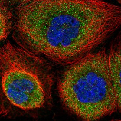 Immunocytochemistry/Immunofluorescence: WDR1 Antibody [NBP2-32665] - Immunofluorescent staining of human cell line A-431 shows localization to cytosol.