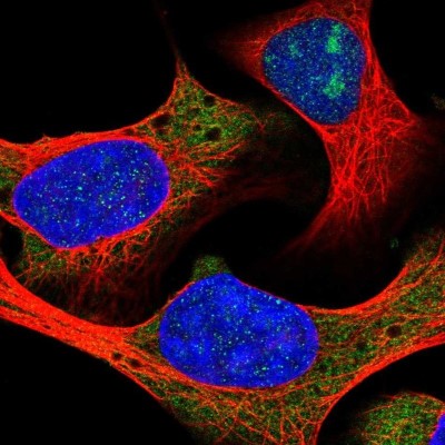 Immunocytochemistry/Immunofluorescence: RPL18A Antibody [NBP2-30708] - Staining of human cell line U-2 OS shows localization to nucleoli, cytosol & endoplasmic reticulum.