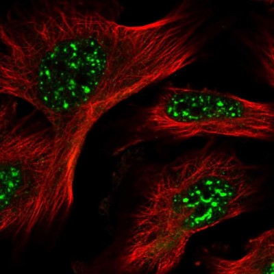 Immunocytochemistry/Immunofluorescence: HSPC014 Antibody [NBP1-90734] - Immunofluorescent staining of human cell line U-251 MG shows localization to nuclear speckles.