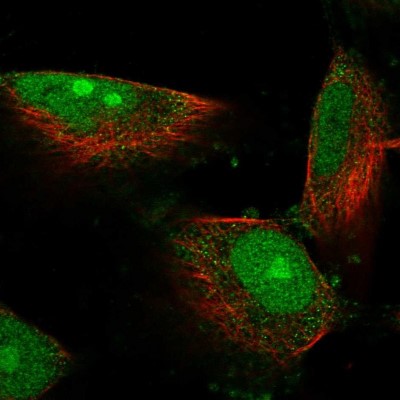 Immunocytochemistry/Immunofluorescence: DIMT1L Antibody [NBP2-30659] - Immunofluorescent staining of human cell line U-251 MG shows localization to nucleus, nucleoli & cytosol.