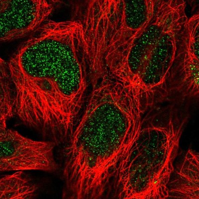 Immunocytochemistry/Immunofluorescence: SUMO-interacting Motif (SIM) Antibody [NBP2-30700] - Immunofluorescent staining of human cell line HEK 293 shows localization to nucleus.