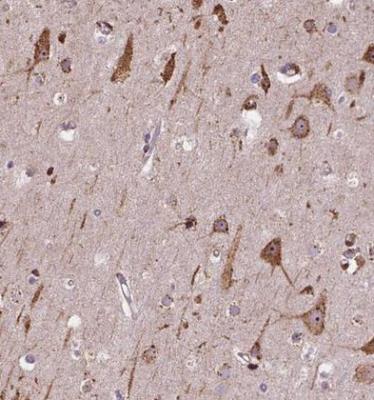 Immunohistochemistry-Paraffin: Importin 11 Antibody [NBP2-49505] - Staining of human cerebral cortex shows strong cytoplasmic and nucleolar positivity in neuronal cells.