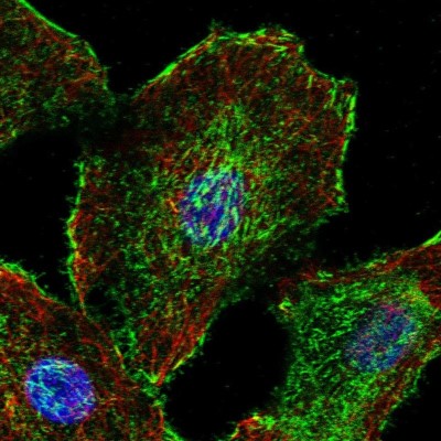 Immunocytochemistry/Immunofluorescence: dystrophia myotonica containing WD repeat motif Antibody [NBP2-49548] - Immunofluorescent staining of human cell line A549 shows localization to plasma membrane & actin filaments.