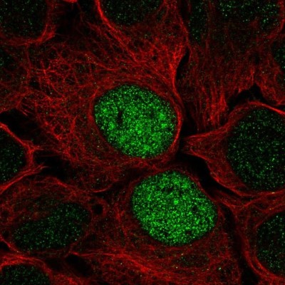 Immunocytochemistry/Immunofluorescence: LZTR1 Antibody [NBP2-49649] - Staining of human cell line U-2 OS shows localization to nucleus.