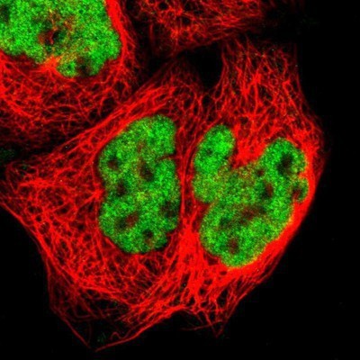 Immunocytochemistry/Immunofluorescence: ZNF384 Antibody [NBP1-86675] - Staining of human cell line A-431 shows positivity in nucleus but not nucleoli.