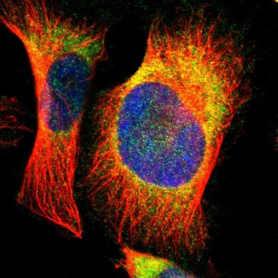 Immunocytochemistry/Immunofluorescence: EBP Antibody [NBP1-85699] - Immunofluorescent staining of human cell line U-251 MG shows localization to endoplasmic reticulum.
