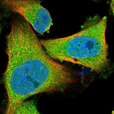 Immunocytochemistry/Immunofluorescence: Axotrophin Antibody [NBP1-90056] - Immunofluorescent staining of human cell line U-251 MG shows localization to plasma membrane & cytosol.